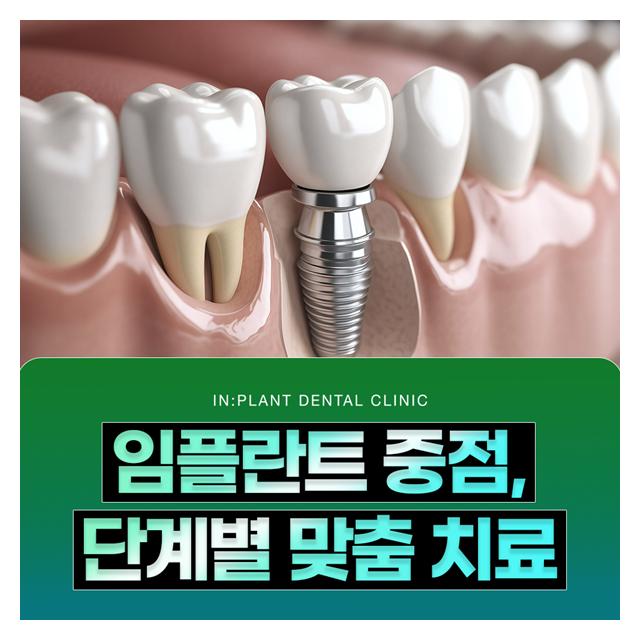 임플란트 중점, 단계별 맞춤 치료