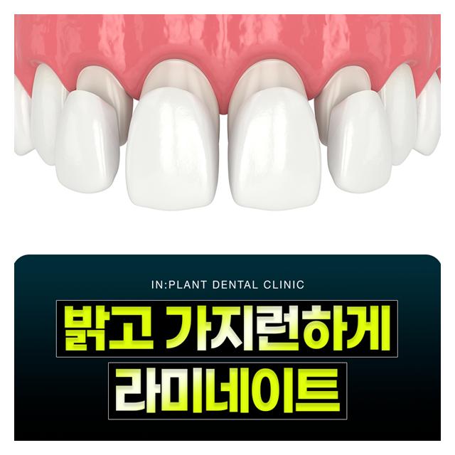 밝고 가지런하게 라미네이트
