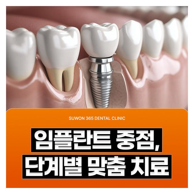 임플란트 중점, 단계별 맞춤 치료로 꼼꼼하게 진행합니다
